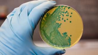 scientist looking at food-borne disease causing microorganisms in a petri dish
